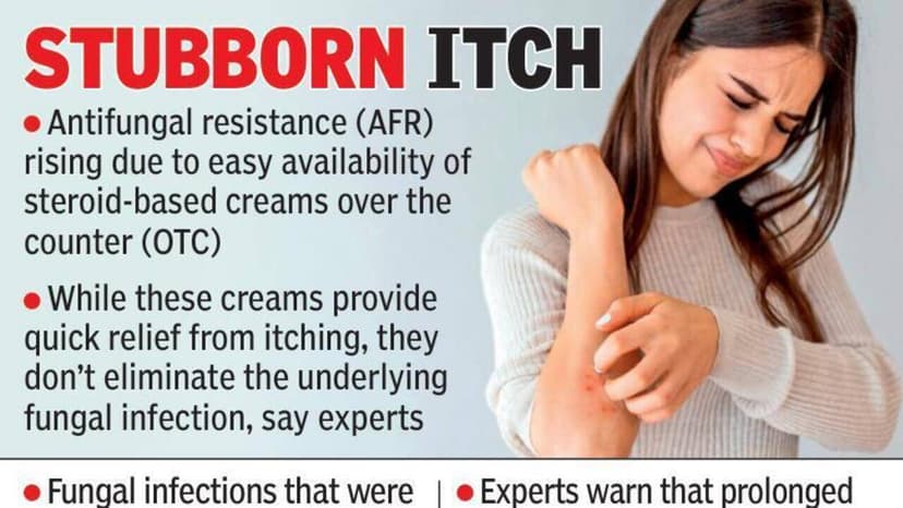 Steroid Creams Fuel Fungal Resistance Crisis
