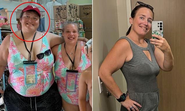 Gastric Sleeve Surgery Nightmare: Woman Suffers 9-Year Ordeal After Botched Procedure