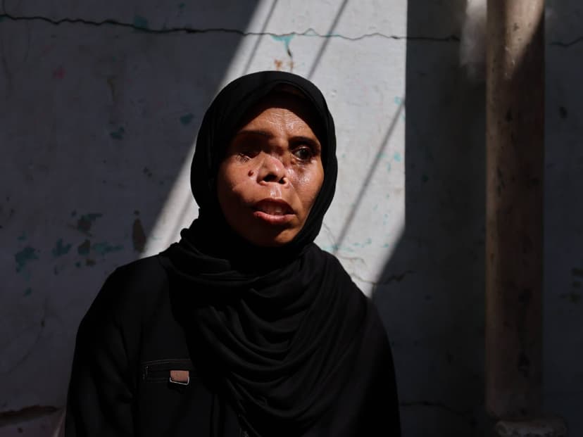 Gaza Woman Survives Blast, Faces Unrecognizable Future