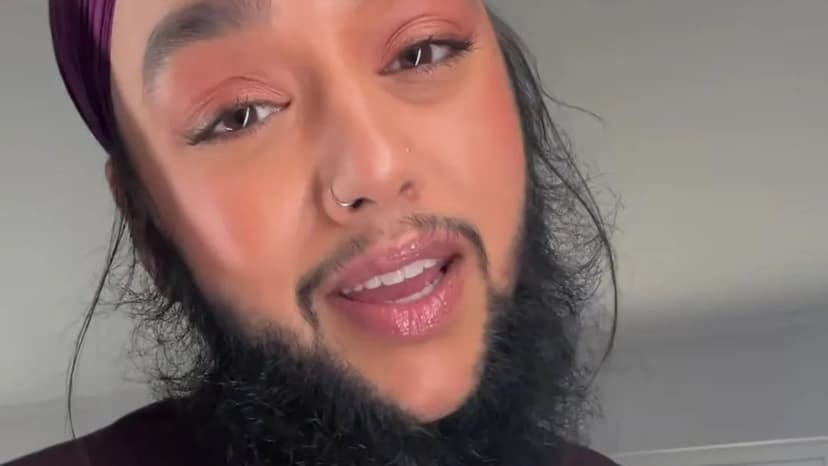 Woman, 35, Embraces Beard Amidst Public Stares