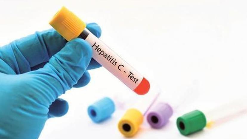 Hepatitis C: The Silent Killer We Can Now Cure