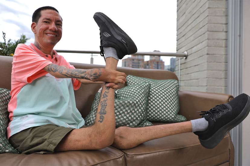 Backward Knees, Forward Spirit: Herson's Joyful Life