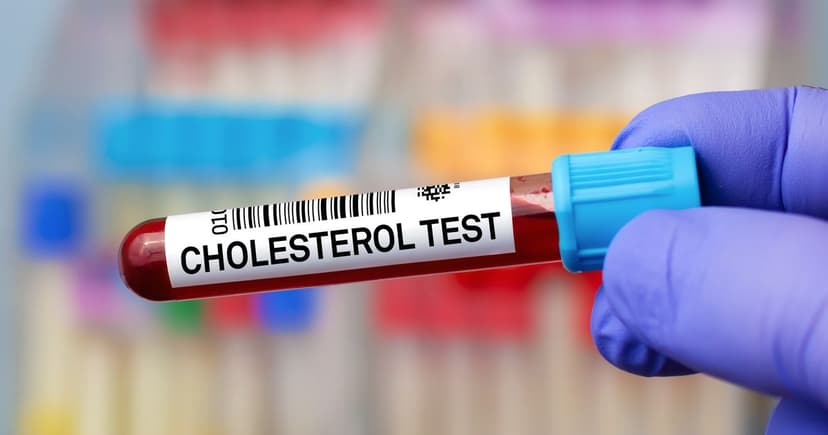 Silent Killer: High Cholesterol's Deadly Toll Revealed