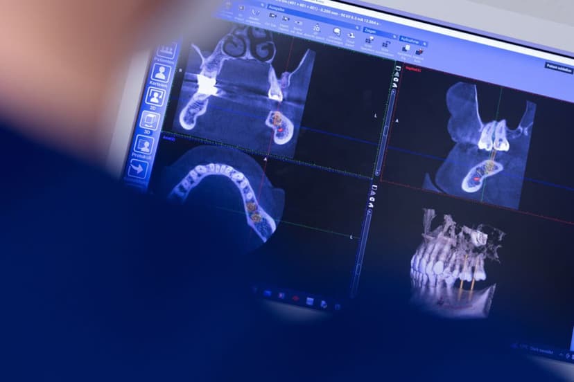 Hillhouse Nears Stake in Modern Dental