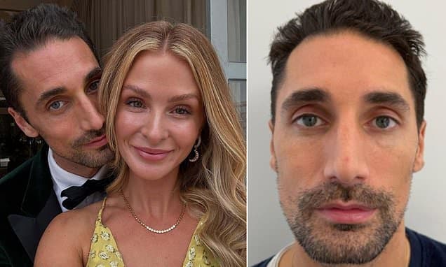 Hugo Taylor's £3k Post-Breakup Facelift