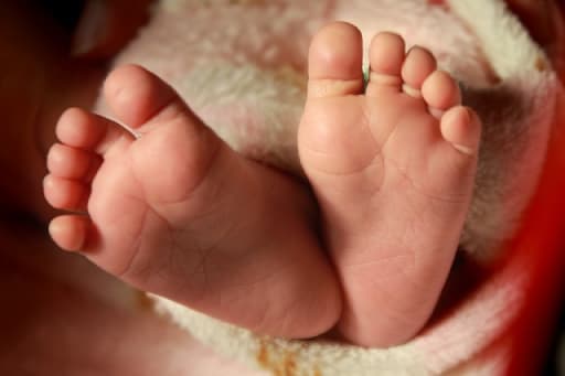 Baby's Eye Muscle Found Near Optic Nerve