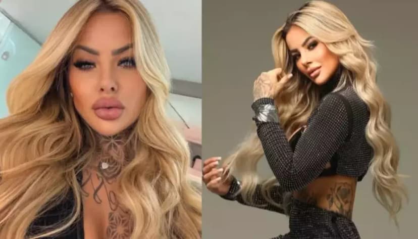 Influencer Dies After Cosmetic Surgery Complications