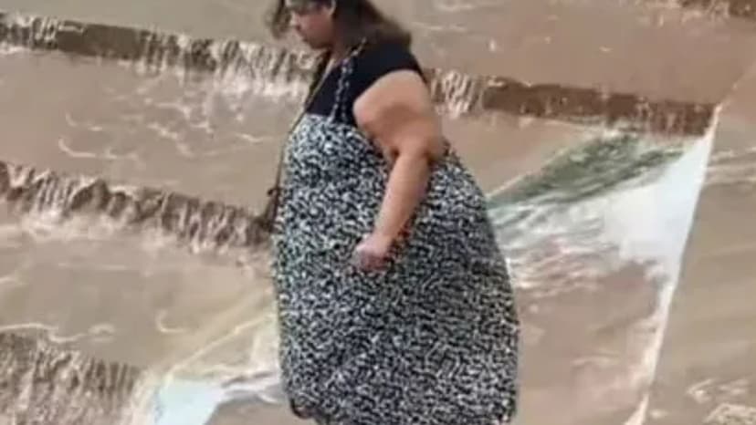 Influencer Embraces Loose Skin Post 12st Weight Loss