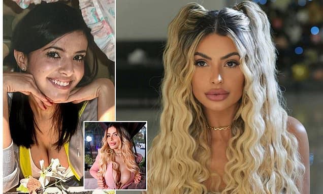 Influencer Spends $90K on Surgery, Can't Recognize Herself
