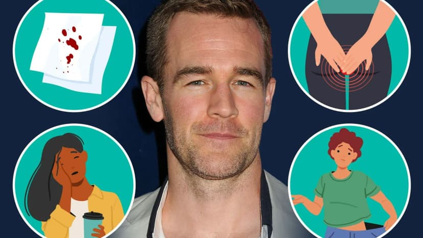 Dawson's Creek Star James Van Der Beek Dies at 47