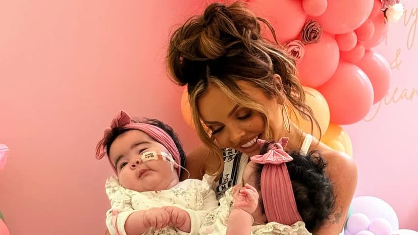 Jesy Nelson's daughters face multiple surgeries