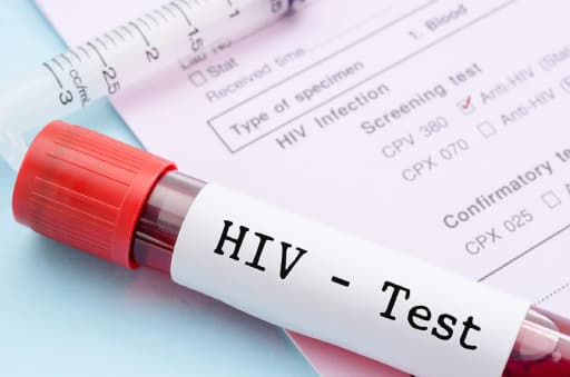 HIV Blood Scandal: Jharkhand HC Demands Action Report