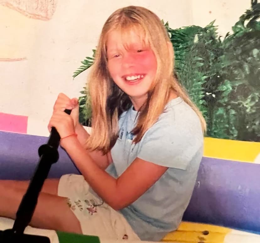 Visible Differences: My Face Isn't a Bruise