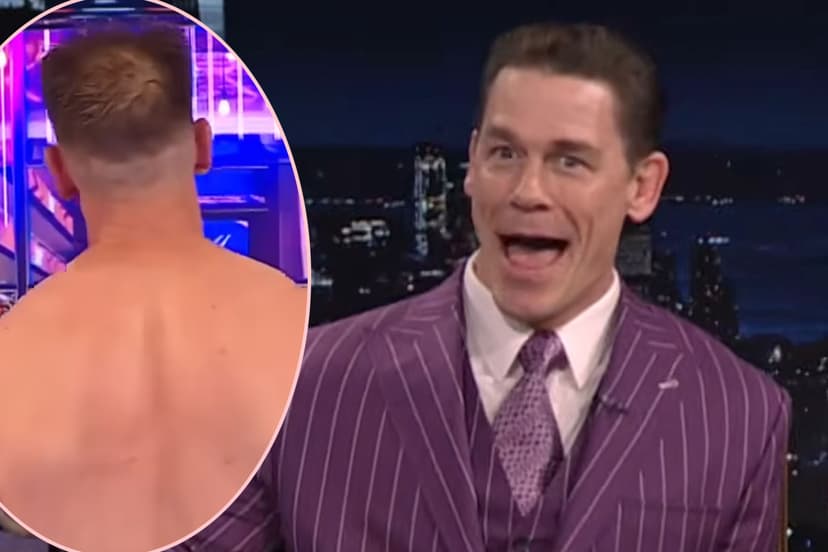 John Cena Debuts New Hair After Two Transplants