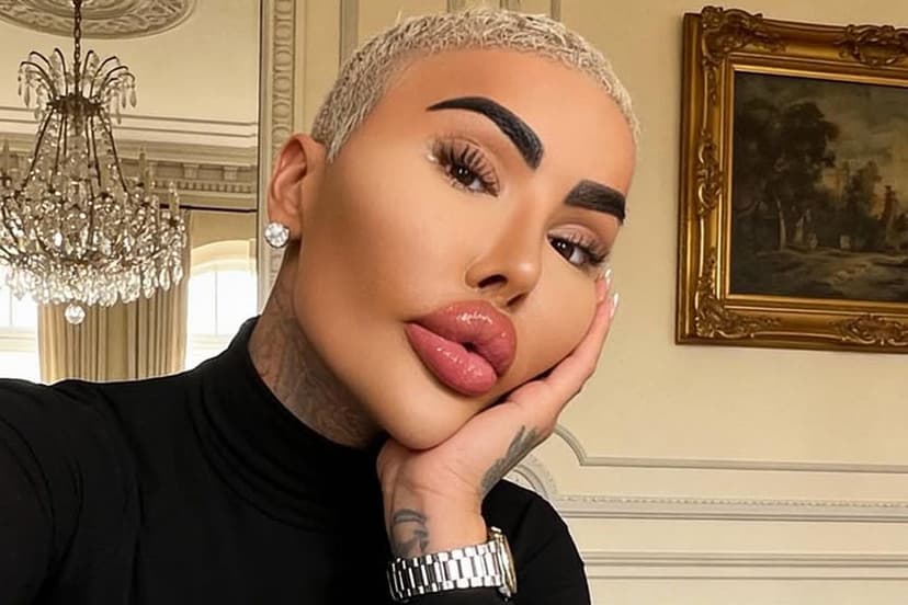 Botched Star Jordan Parke Dead at 34