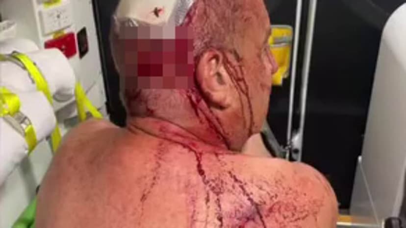 Retiree Mauled Saving Dog from Aggressive Kangaroo