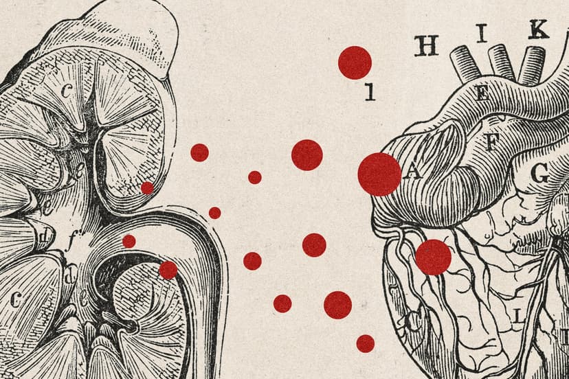 Kidney Disease's Toxic Secret for Your Heart Revealed