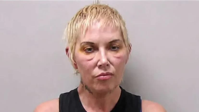 Eminem's Ex-Wife Hospitalized Amid Legal Woes