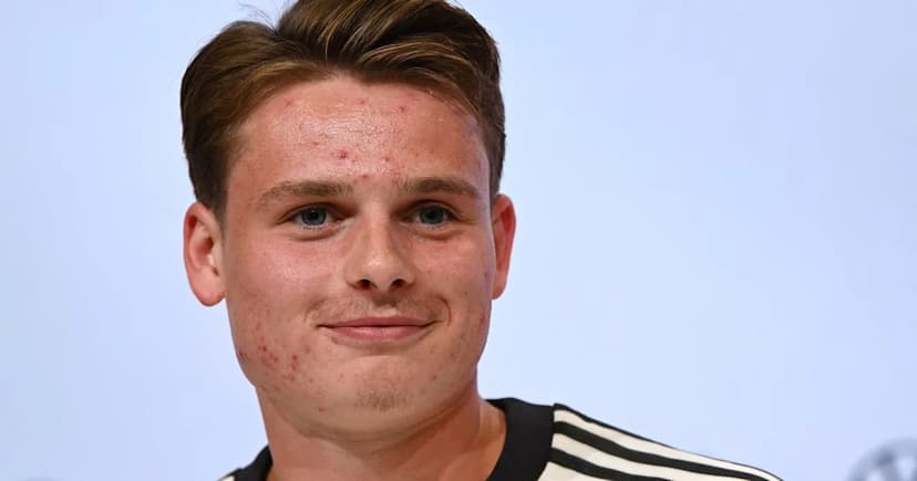 Klopp Bets on Urbig for Greece Showdown