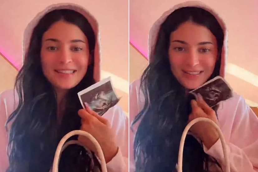 Kylie Jenner's Wallet Holds Ultrasound Keepsakes