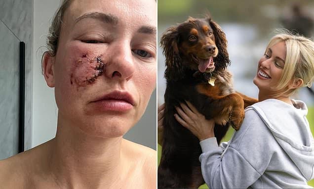 Laser Treatment Restores Confidence After Traumatic Dog Attack