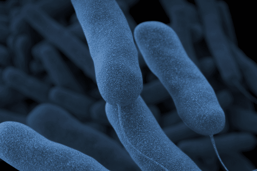 Guest Dies of Legionnaires' Disease; Lawsuit Targets Vegas Hotels
