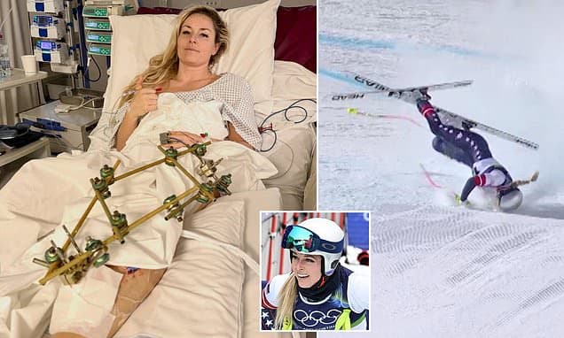 Vonn's defiant Olympic return: 'I did it. I won.'