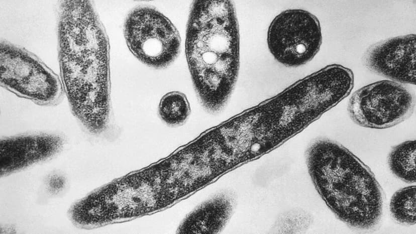 London Legionnaires' Outbreak: Health Alert Issued