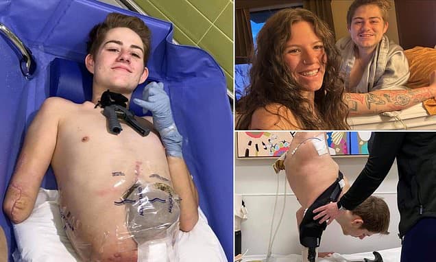 Man Cut in Half by Forklift Survives