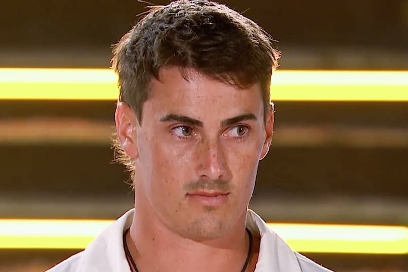 Love Island Star's Near-Fatal Bonfire Accident