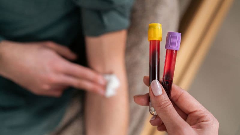 Low Liver Enzymes Signal Colorectal Cancer?