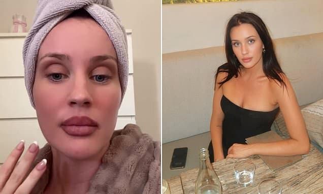 Botox Mishap Leaves MAFS Bride With Collapsed Face