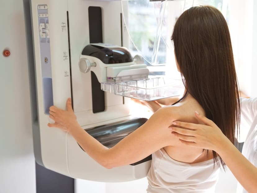 Mammograms Reveal Hidden Heart Risk in Women