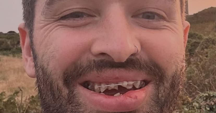 Cyclist collision costs man £30,000 in dental bills