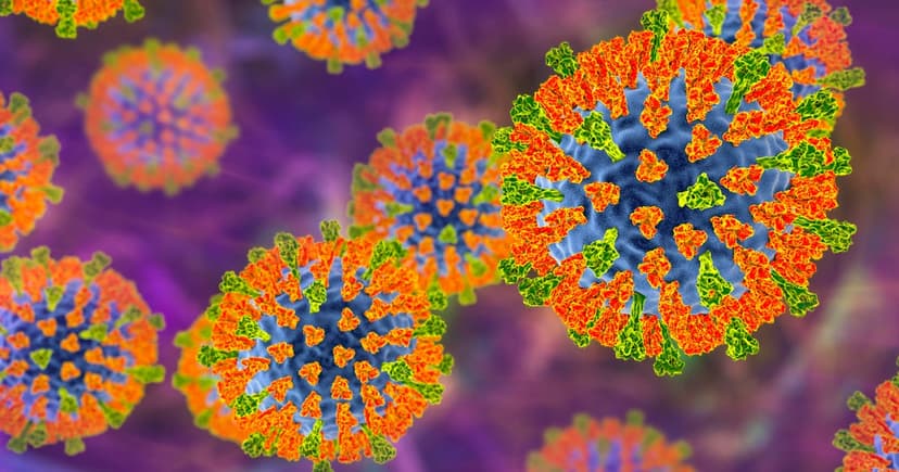 Maryland Measles Outbreaks: 14 New Cases Erupt