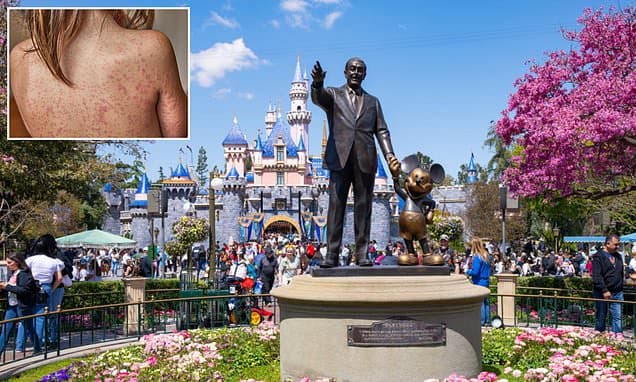 Measles Scare: Disneyland & LAX Visitors Warned