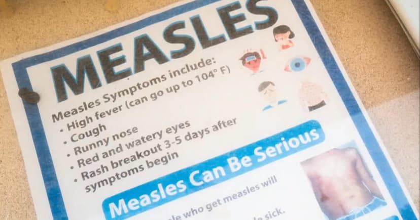 Measles Alert: Travel Route Through Maryland Exposed