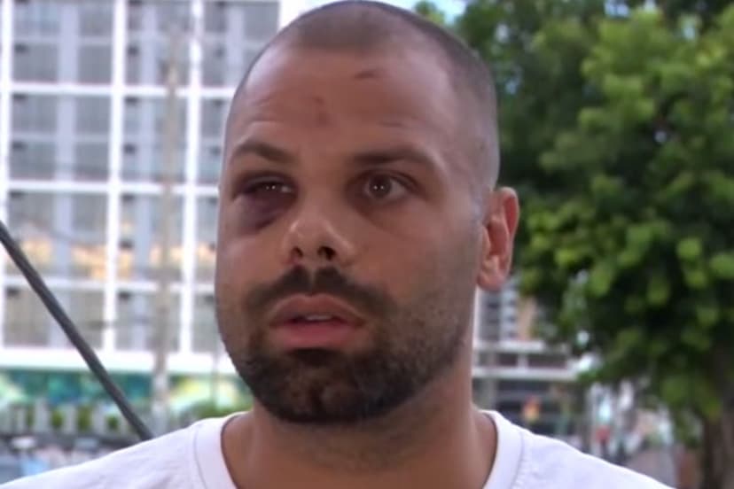 Pit Bulls Attack Jogger in Miami