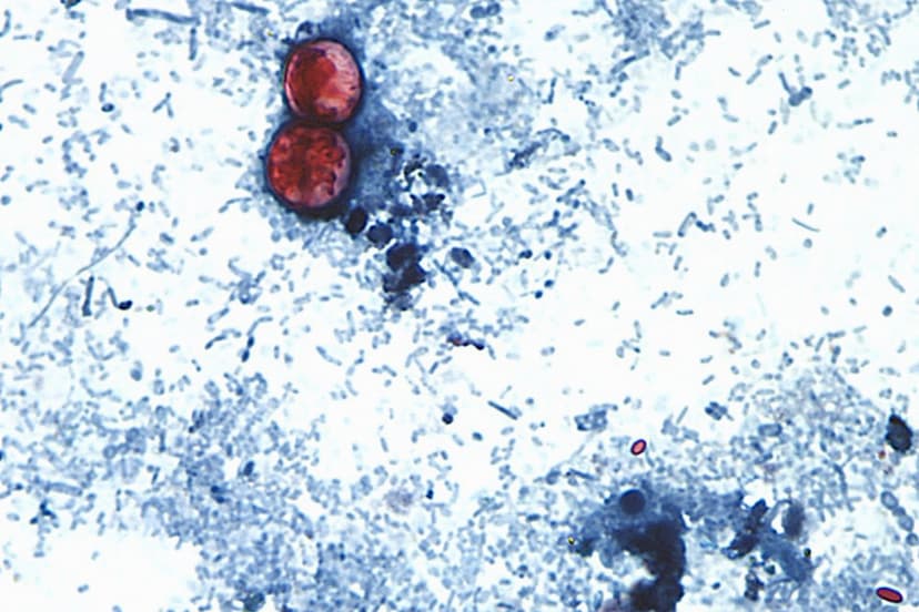First Cyclospora Fatalities in Michigan