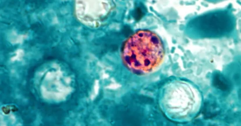 Michigan Cyclospora Outbreak Surges: Over 11,500 Cases Reported