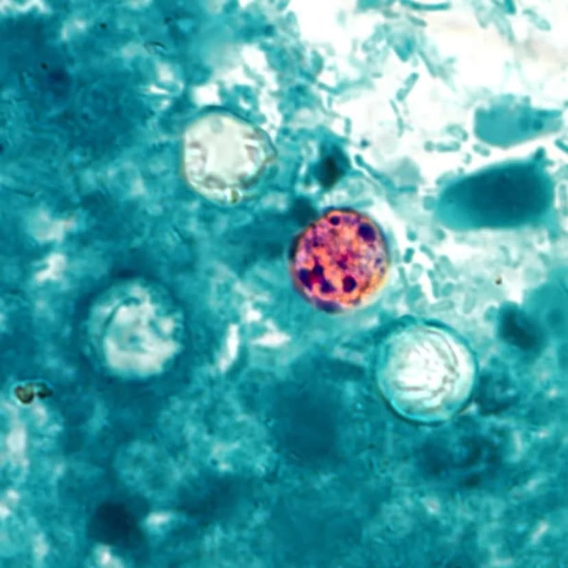 Michigan Cyclospora Outbreak Spirals!