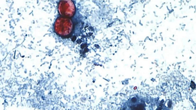 Michigan Cyclosporiasis Cases Skyrocket Past 3,000