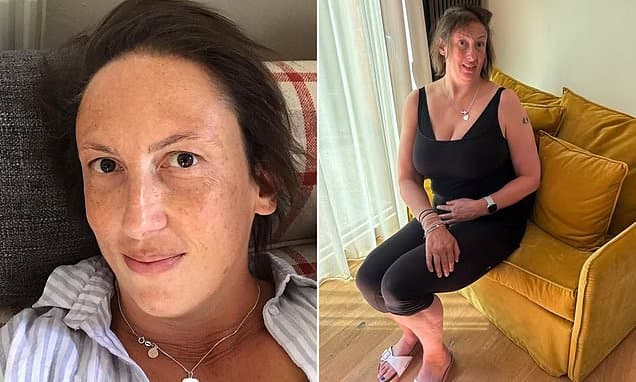 Miranda Hart Reveals Ankle Injury Amidst Healthcare Anxiety