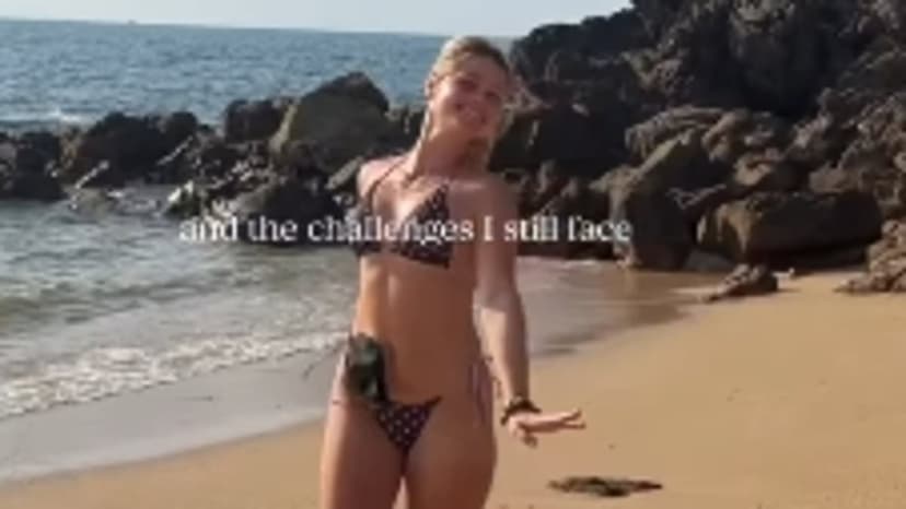 Mollie Pearce: Stoma bag travel challenges revealed