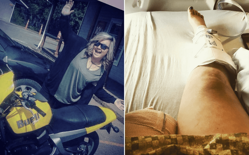 Mom Loses Limbs in Drunk Driving Crash