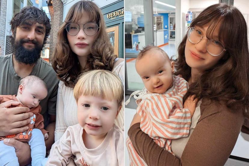 Mom's Intuition: Baby's Odd Head Shape Leads to Rare Diagnosis