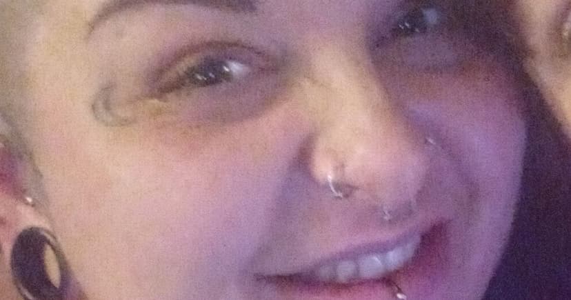 Mum Loses 90lbs, Seeks Surgery for Loose Skin