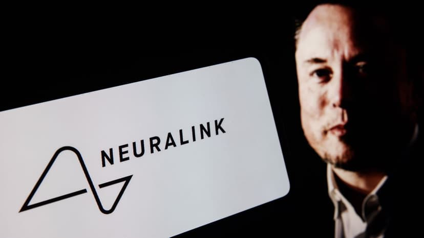 Neuralink Patient Masters Warcraft Via Brain Implant