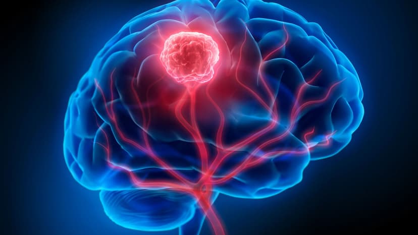 Revolutionary Blood Test Spots Brain Cancer