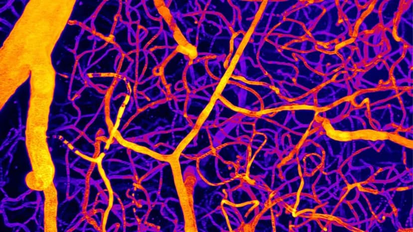 Fat Molecule Could Reverse Brain Flow Issues